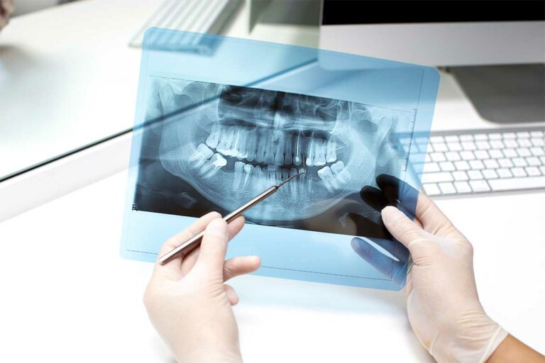 dentist-analyzes-x-ray-photo